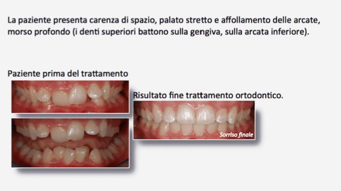 Ortodonzia Monza
