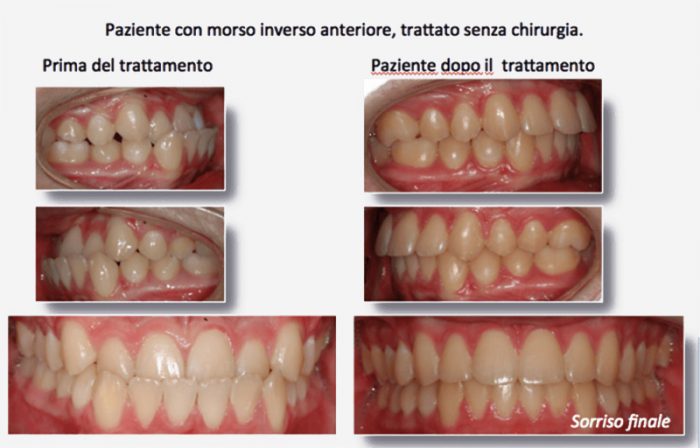 ortodonzia estetica Monza